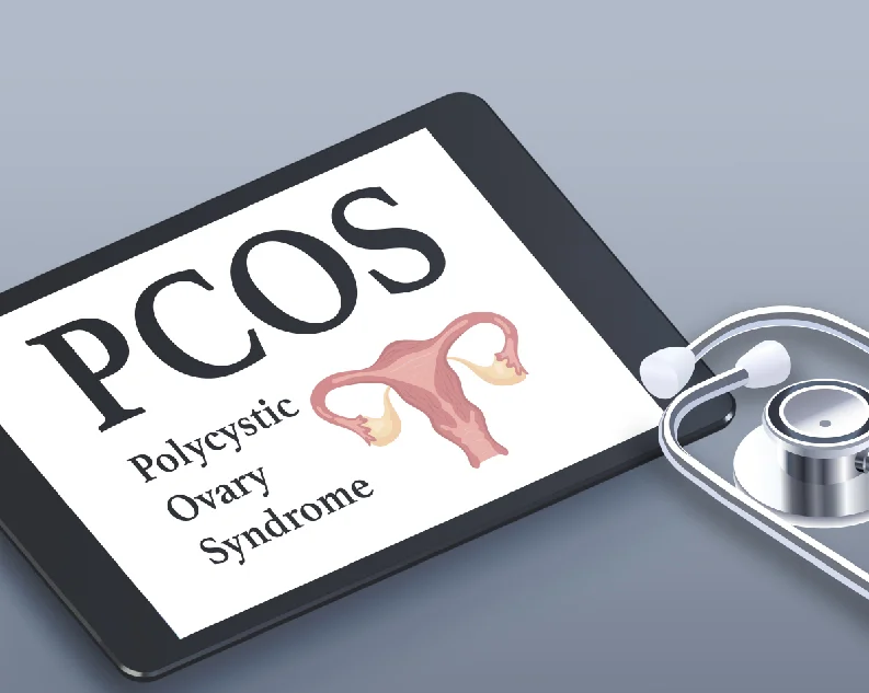Polycystic Ovary