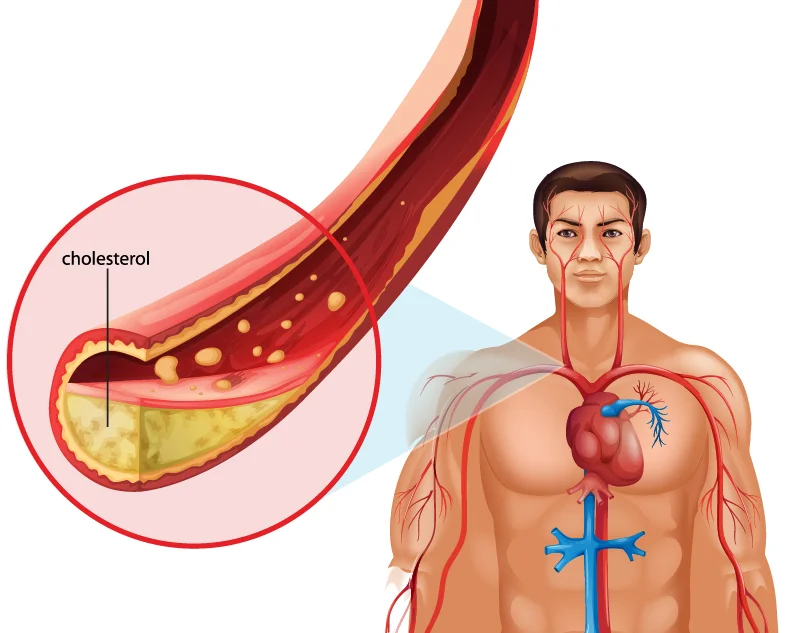 Lipid &